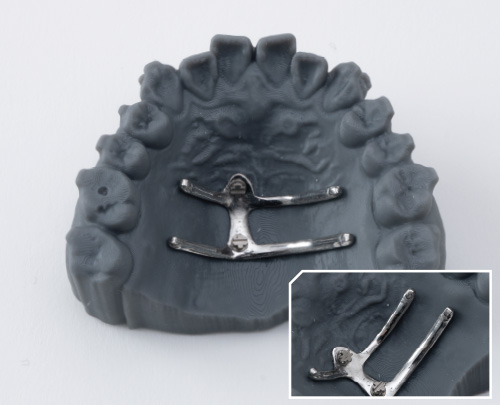 Intrusion Plate