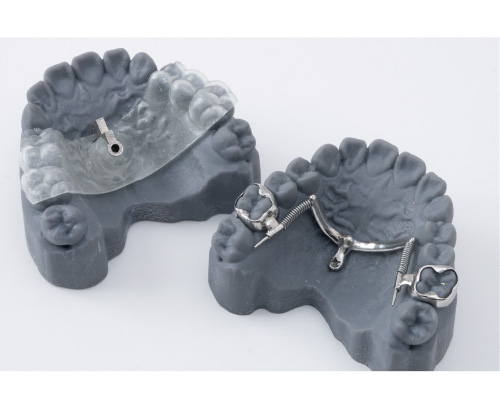 Molar Slider for Upper